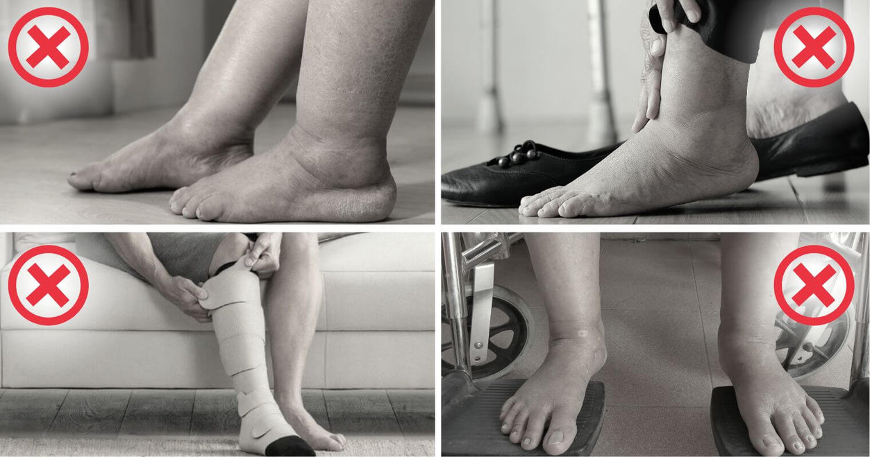 Swollen ankles evening